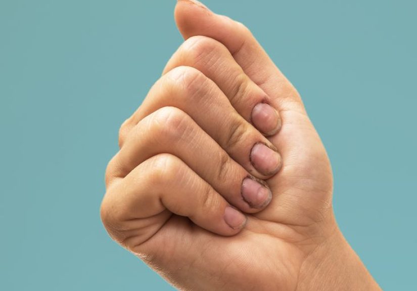 Bad Hygiene: Meaning, Signs, & Why It Matters