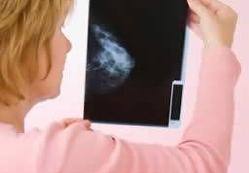 Breast Cancer Survival Better After Lumpectomy Than Mastectomy