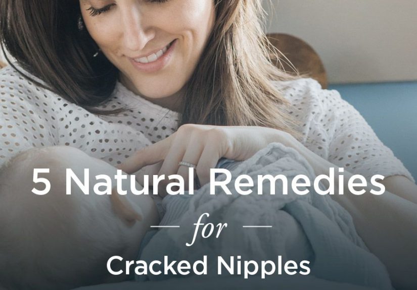Cracked Nipples: Natural Remedies