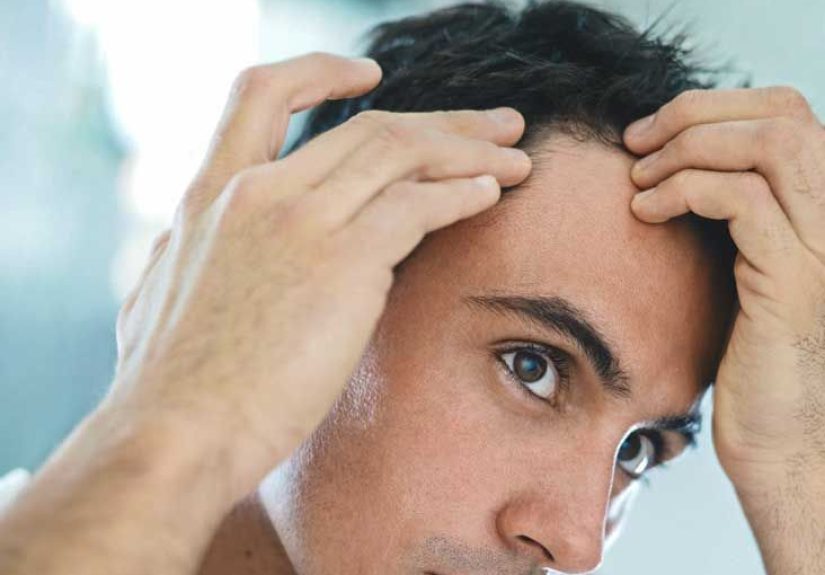 Folliculitis Decalvans: Pictures, Treatments, Symptoms, and Causes