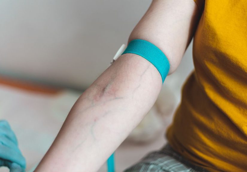 Green Veins: Why They’re That Color, Plus Conditions to Be Aware Of