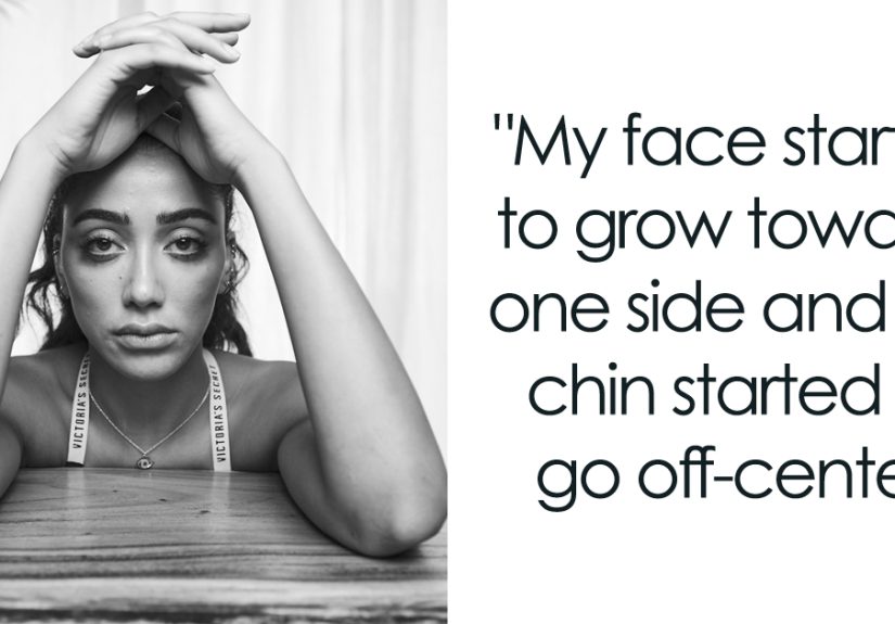 I Show Raw Pictures And Unedited Stories Of People And Their Body Insecurities (19 Pics)