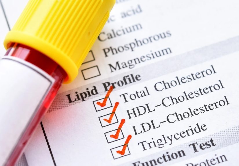 Link Title max 70 char Preguntas frecuentes sobre el colesterol