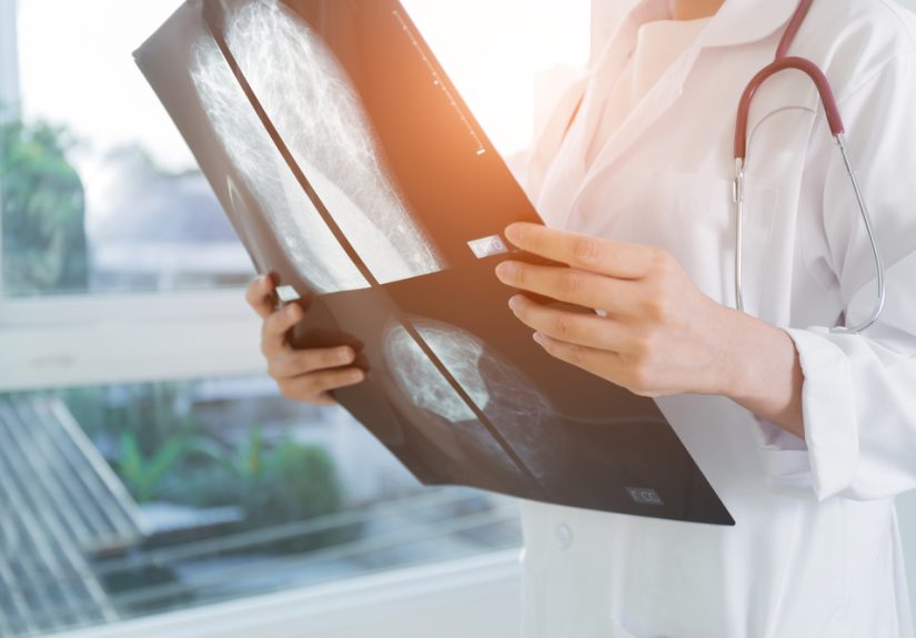 My Faith in Healthy Lifestyle Choices Is Shaken