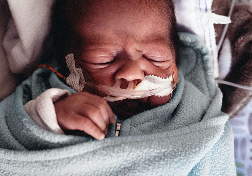 Necrotizing enterocolitis: Symptoms, causes, and treatment