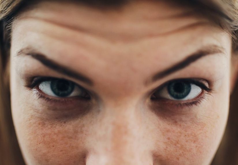 Nonsurgical Eye Lift: What Is It and Does It Work?