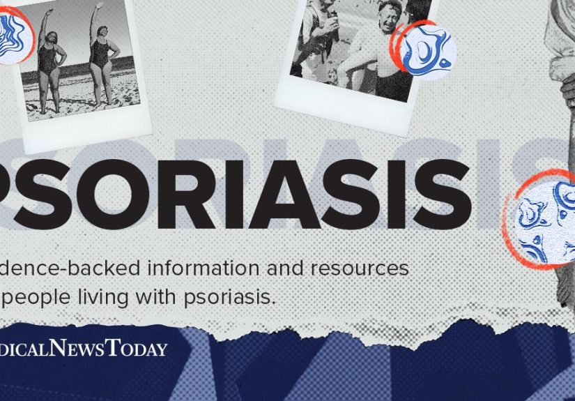 Psoriasis: Resources on Types, Causes, Treatments, and More