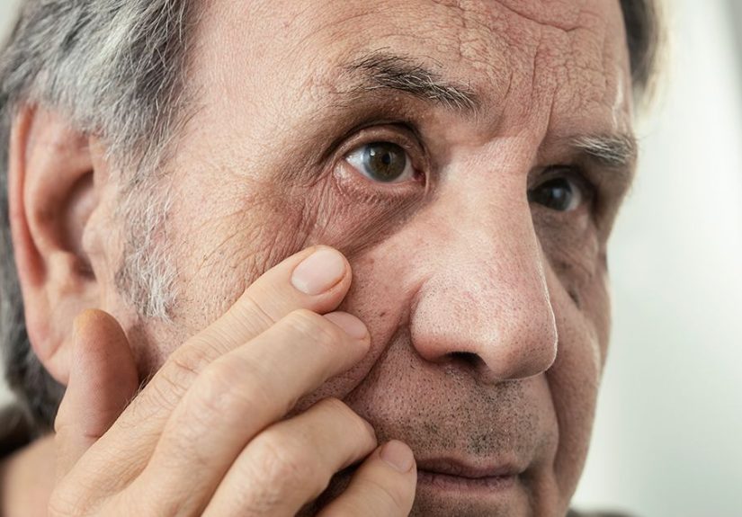 Shingles Complications and How to Treat Them