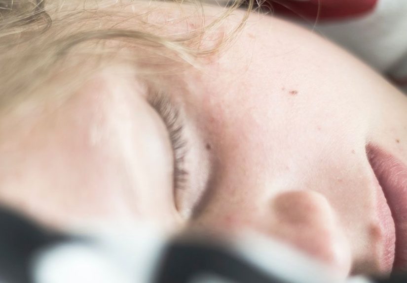 Sticky Eyes: What Is It and How Do I Treat It?