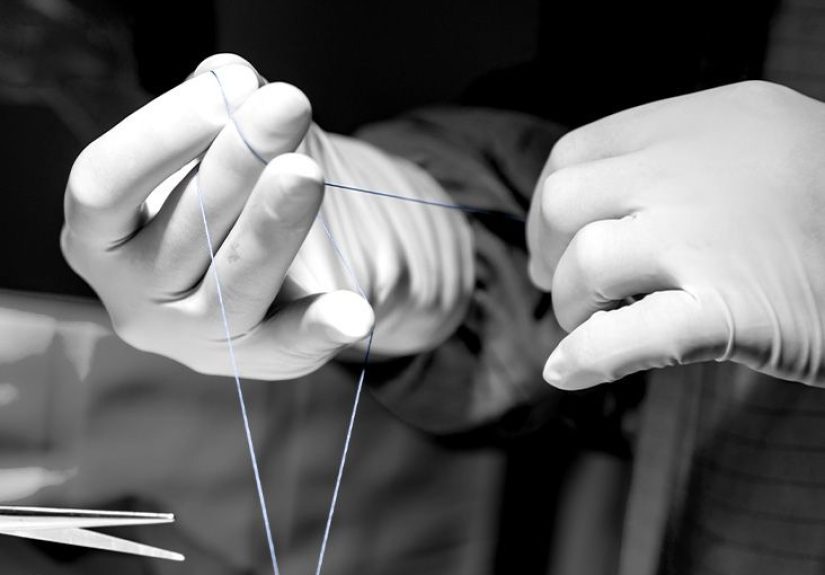 Surgical sutures: Types, techniques, and how to take care of them
