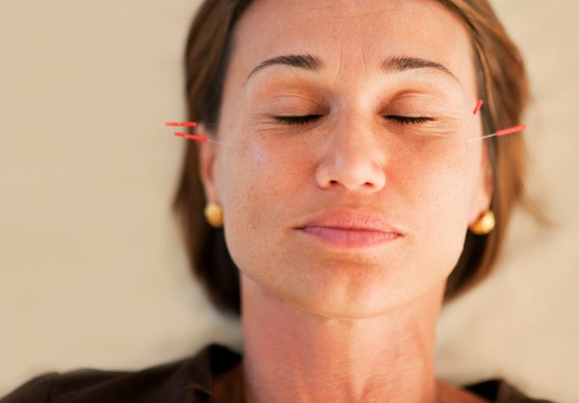 Symptoms of Menopause Acupuncture Might Help Relieve