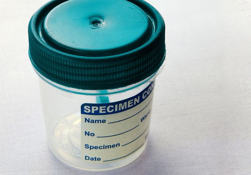 Testing for parasites on Medicare