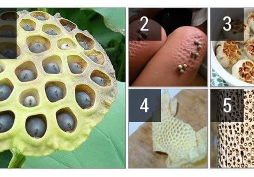 These Vomit-Inducing Photos Will Trigger Your Trypophobia