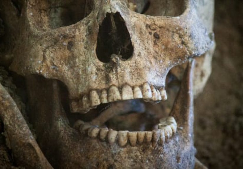 Top 10 Criminal Cases Involving Human Teeth