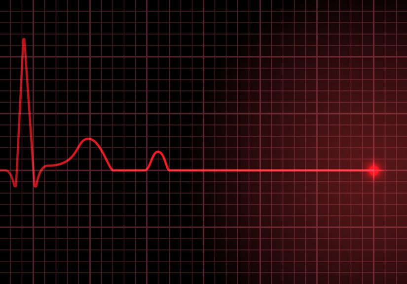 Tragedy strikes Monday Night Football as Buffalo Bills safety Damar Hamlin suffers cardiac arrest. Is commotio cordis to blame?