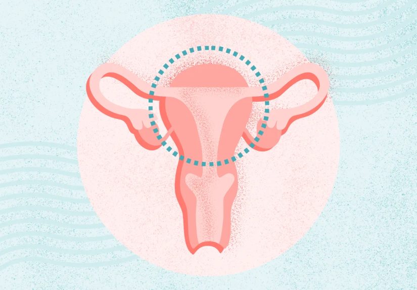 What Is Abortion? Purpose, Risks, Preparation, Recovery