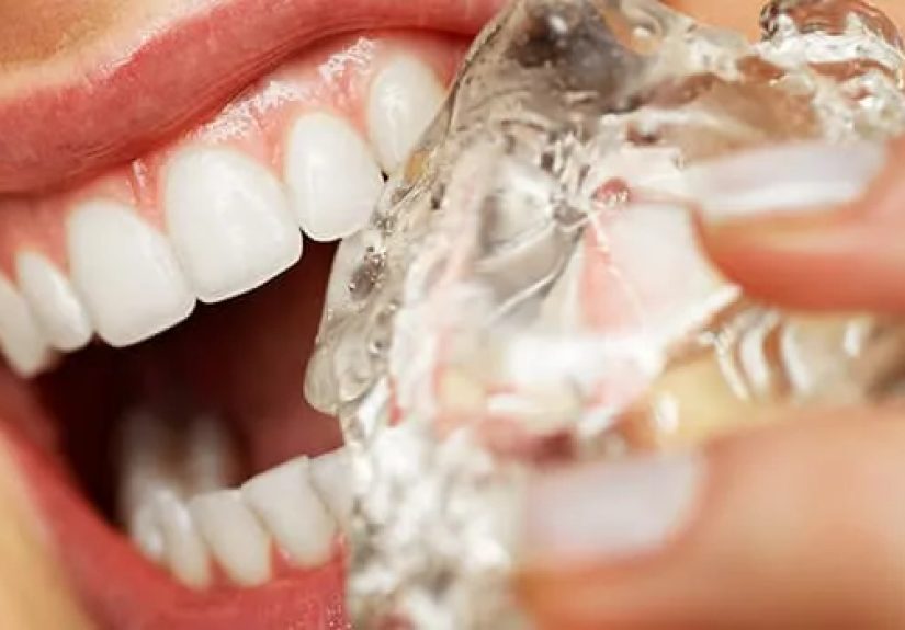 19 Habits That Wreck Your Teeth