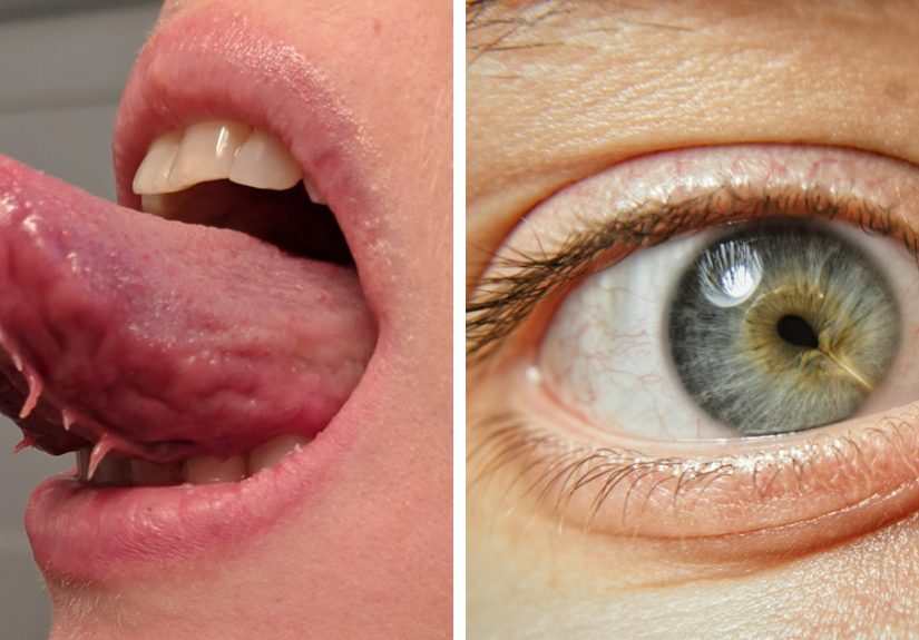 30 People Whose Genetics Made Them Unique