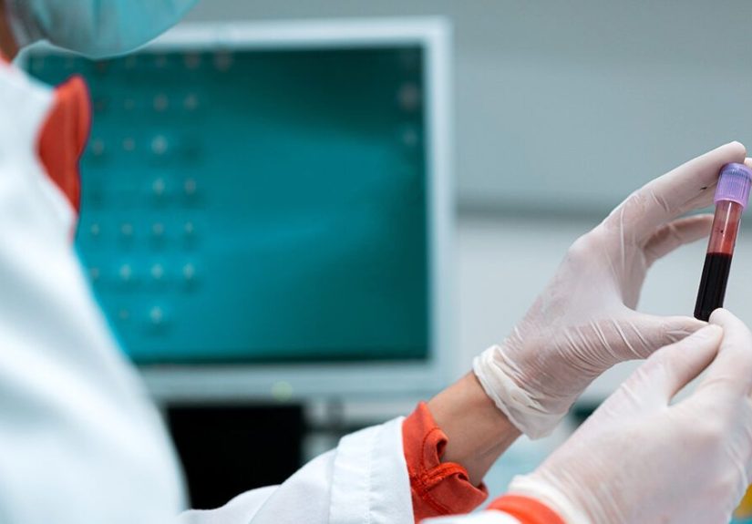 Alcohol Blood Tests: Types, Uses, and Results