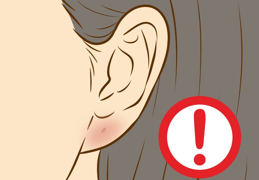 How to Get Your Ears Pierced