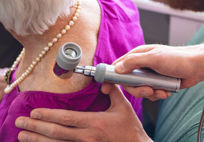 Squamous Cell Carcinoma: Pictures, Symptoms, and More