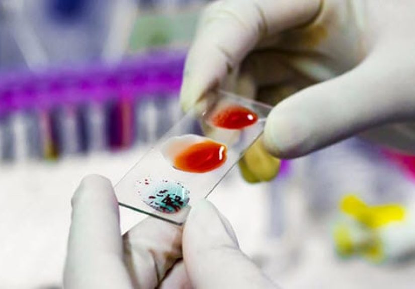 10 Things So Rare They’ve Only Been Found Once