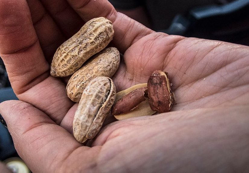 Biotin: Benefits, Sources, and Safety