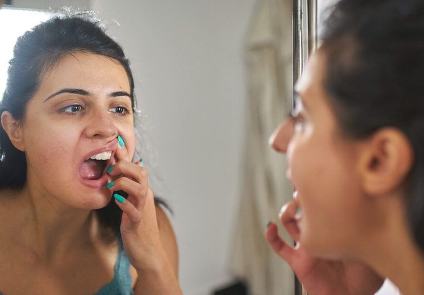 Black Tartar on Teeth: Causes and How to Get It Removed