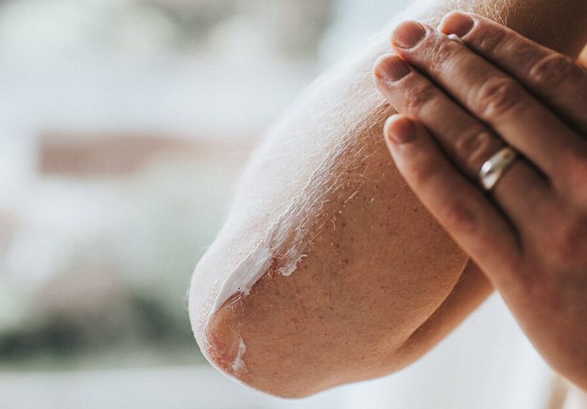 Does Glucosamine Work? Benefits, Dosage and Side Effects