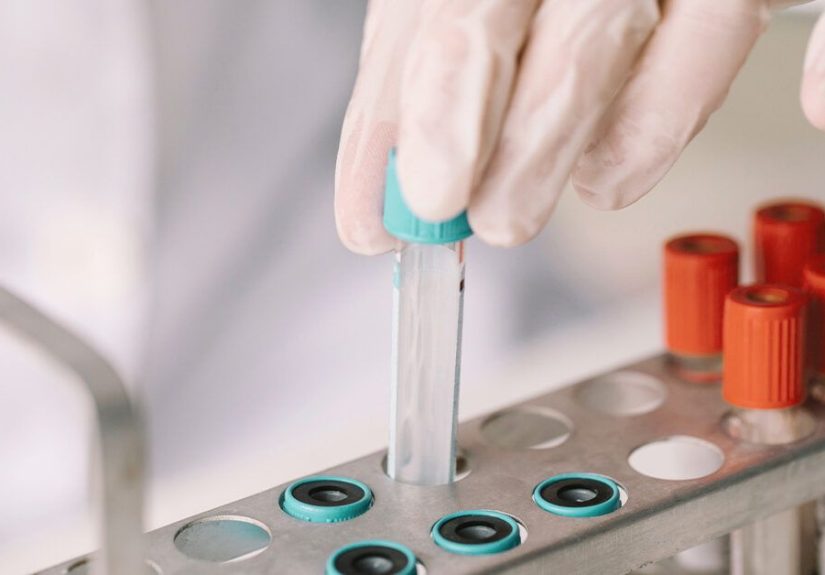 Double Marker Test: How It’s Done and What Results Mean