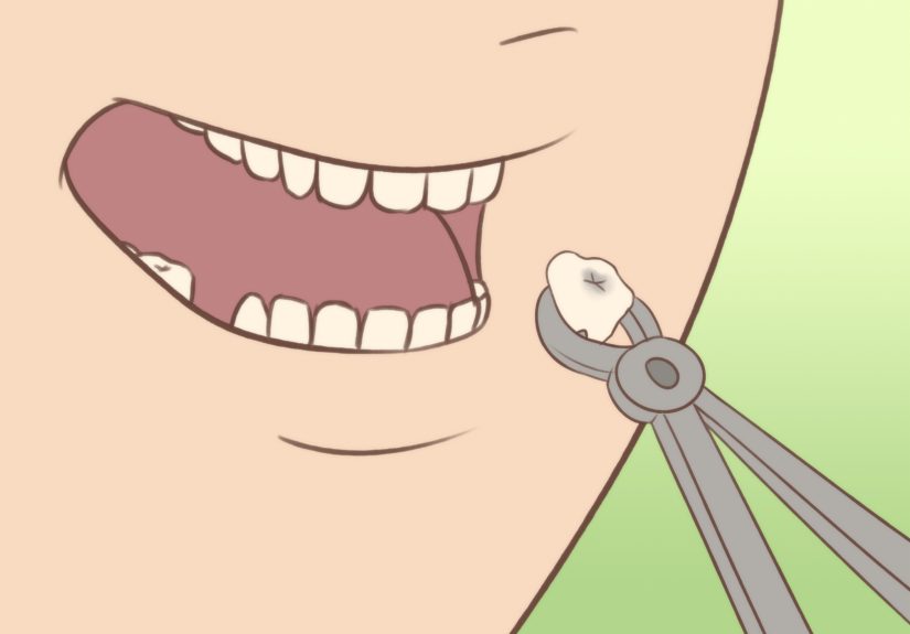 How to Alleviate Toothache Pain: 11 Steps