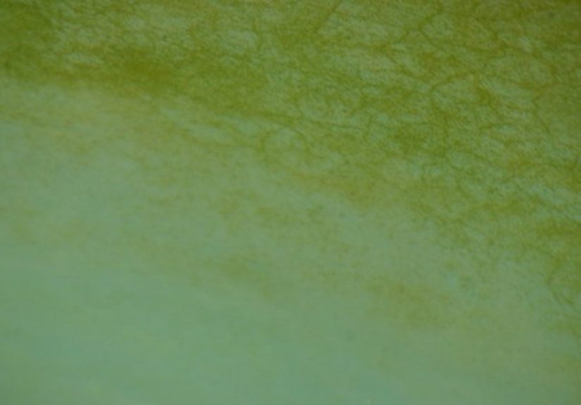 How to Remove Dead Algae From a Swimming Pool