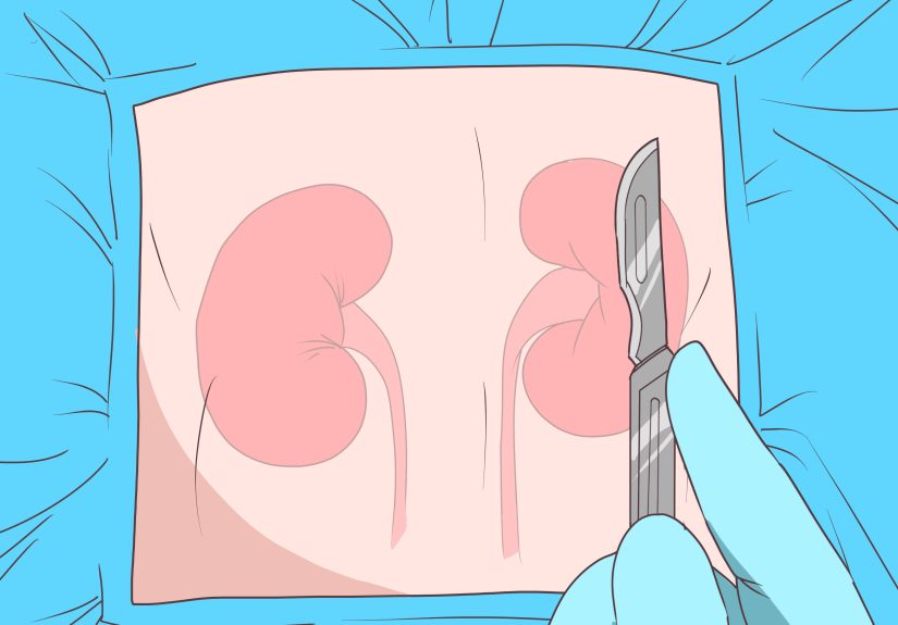 How to Repair Kidney Damage: Natural & Medical Remedies