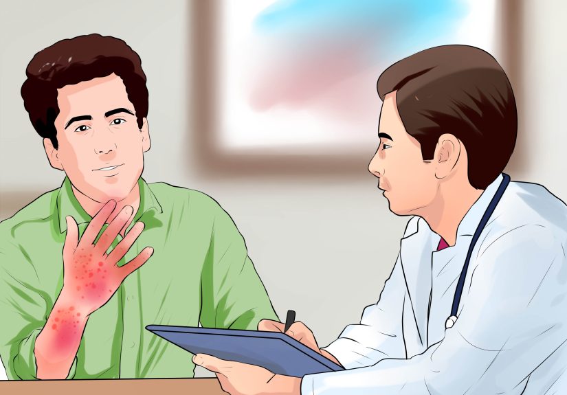 How to Treat Contact Dermatitis: 15 Steps