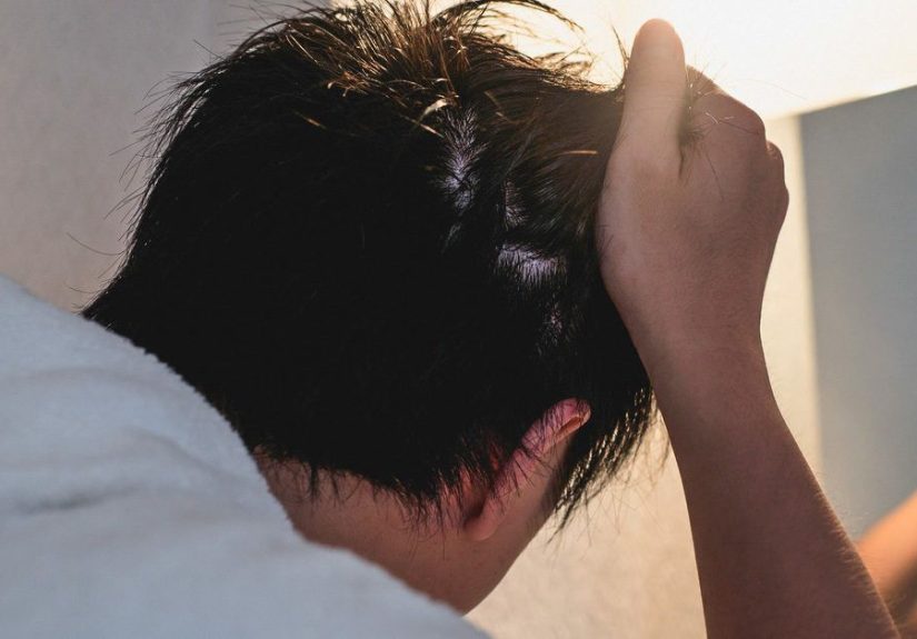 Microneedling for Hair Loss: Is It Effective?