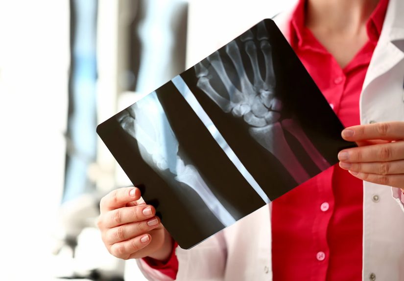 Simple Steps to Strengthen Your Bones