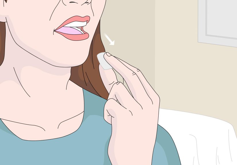 Simple Ways to Fold Gauze for Your Mouth: 12 Steps