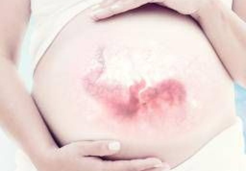 What happens to the immune system during pregnancy?