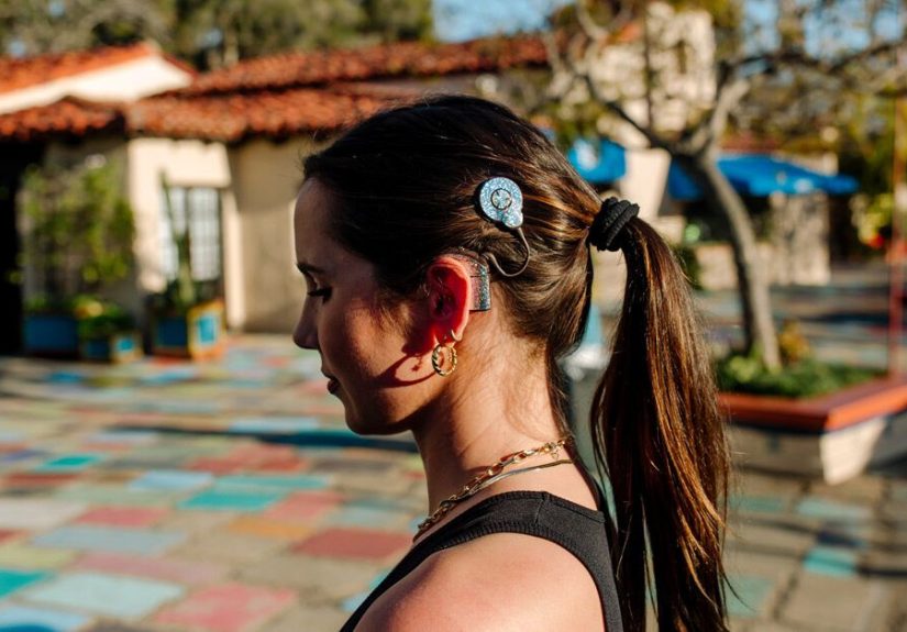 Your Guide to Rehab After Cochlear Implant