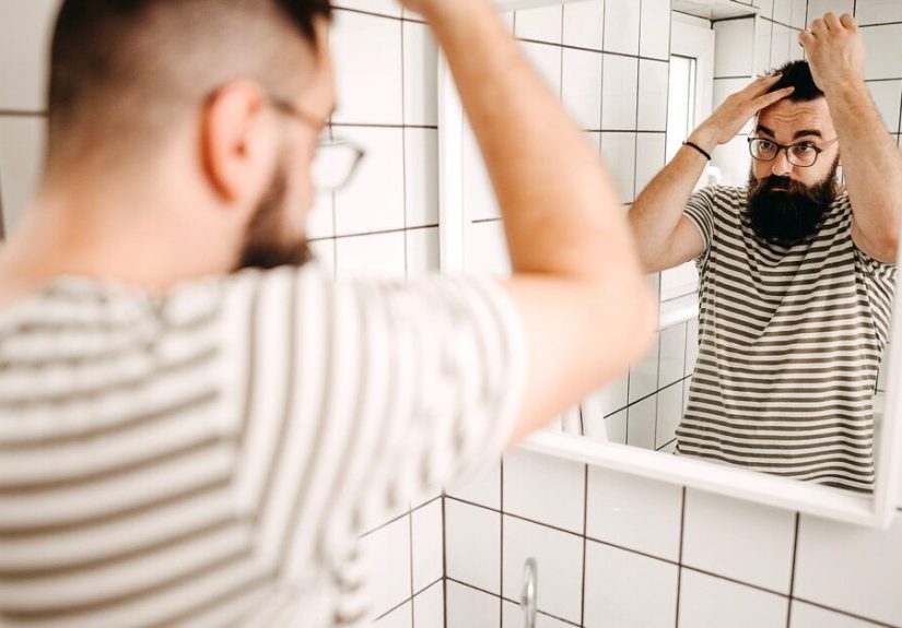 12 Ways to Stop a Receding Hairline