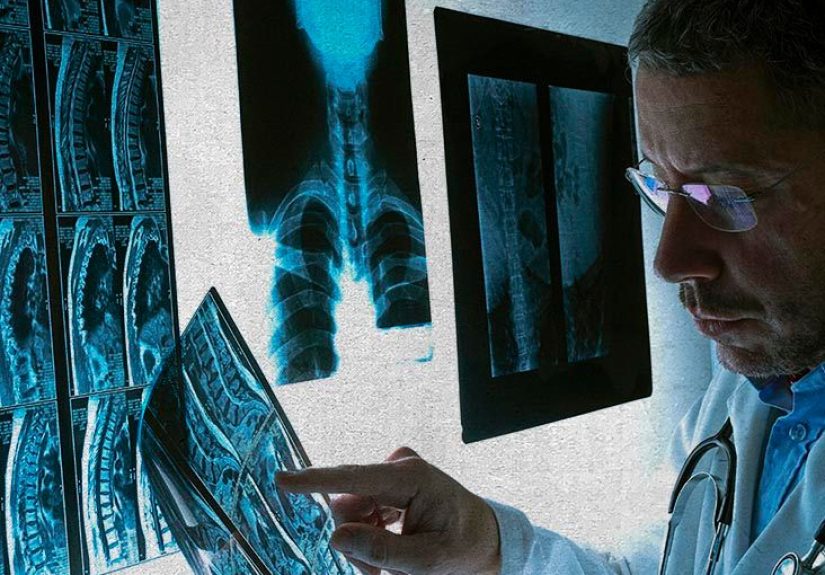 Bone Cancer Types: Symptoms, Treatments, and More