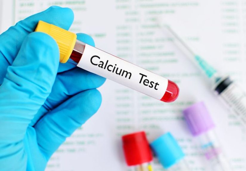 Calcium Blood Test: Normal Range, High, Low