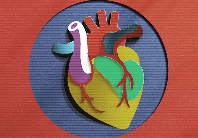 Coronary Artery Disease: Causes, Symptoms, and Treatment