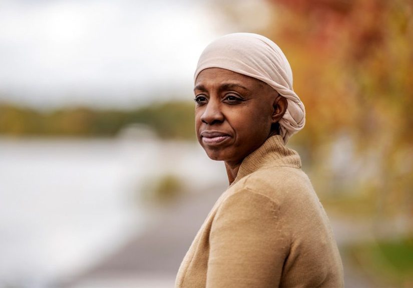 Hair loss and breast cancer in Black females