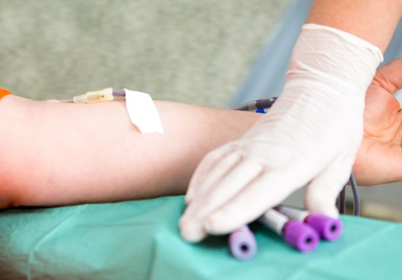 Normal pH of Blood in Humans: What Actions Affect It?