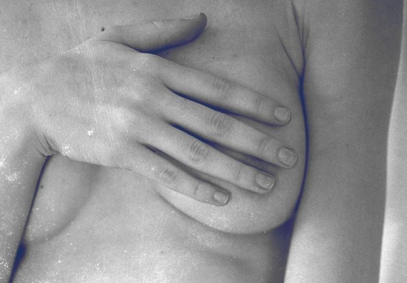 Scattered Fibroglandular Breast Tissue