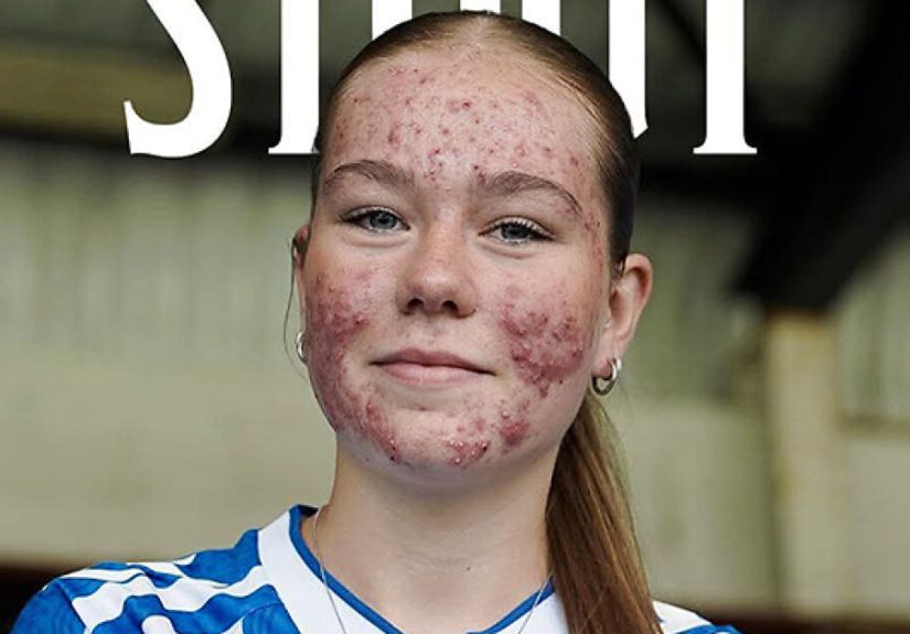 Soccer Team Forced To Take Down Announcement Of New Signing After Trolls Come After Her Appearance