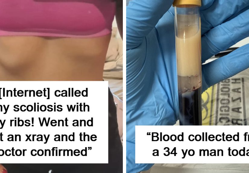 42 Medical Posts That Prove Truth Is Sometimes Stranger Than Science Fiction
