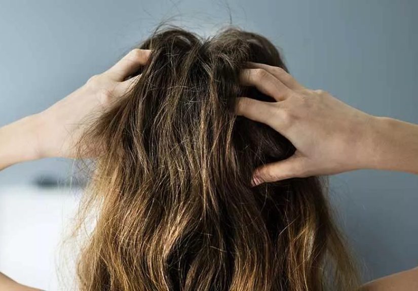 Itchy Scalp: 8 Common Causes and Cures