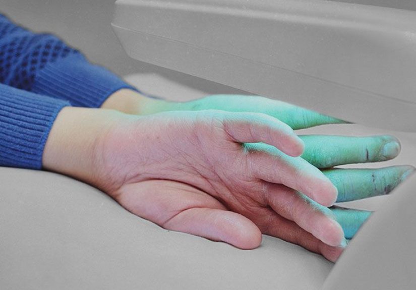 Light therapy for psoriasis: Types, effectiveness, and side effects